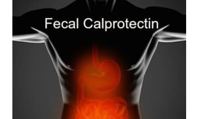 کیت کالپروتکتین - کیت Calprotectin - التهاب روده و کلپروتکتین – روش سنجش کیفی کلپروتکتین