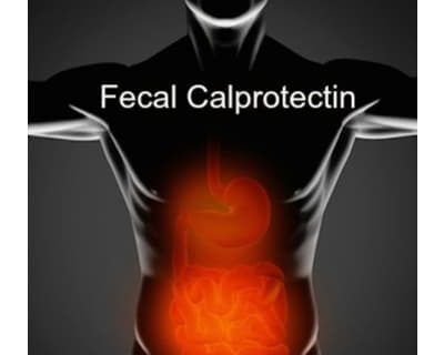 کیت کالپروتکتین - کیت Calprotectin - التهاب روده و کلپروتکتین – روش سنجش کیفی کلپروتکتین