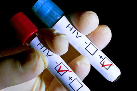 نتایج آزمایش HIV