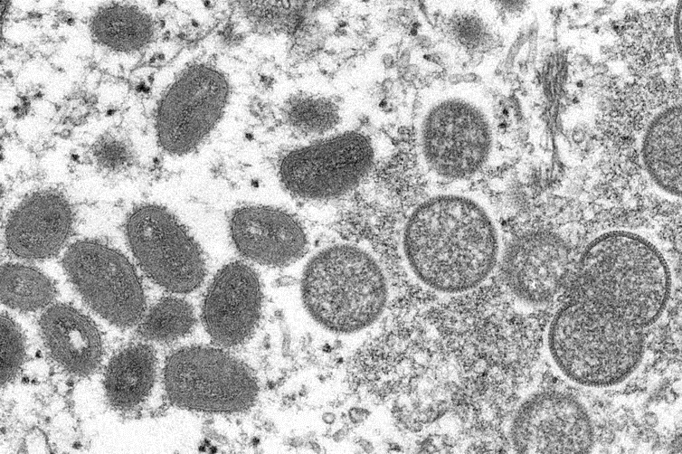 تصویری از ویروس‌ های آبله خویشاوندان ویروس آبله میمون